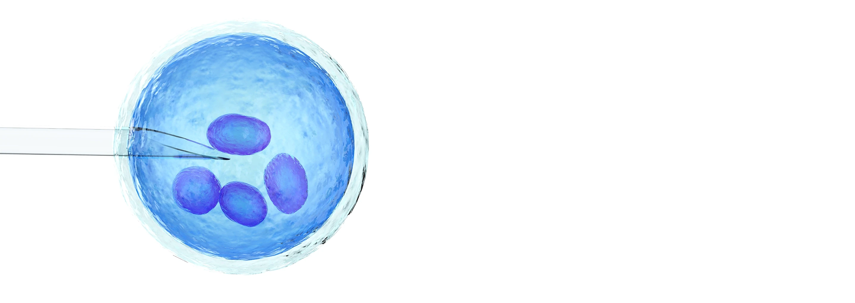 ivf